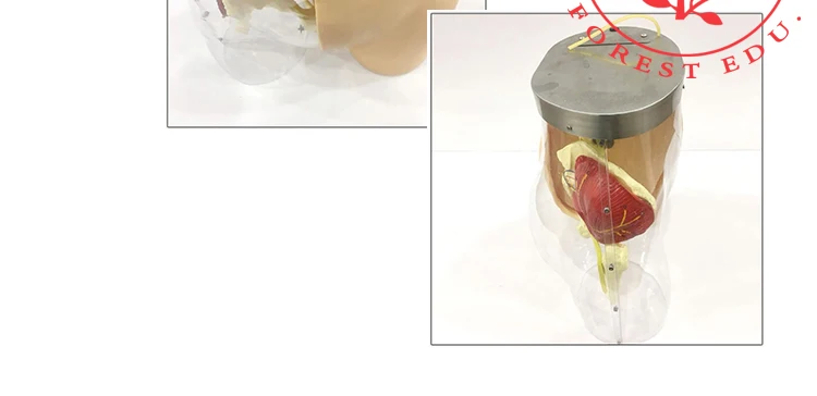 11 Injection model.jpg