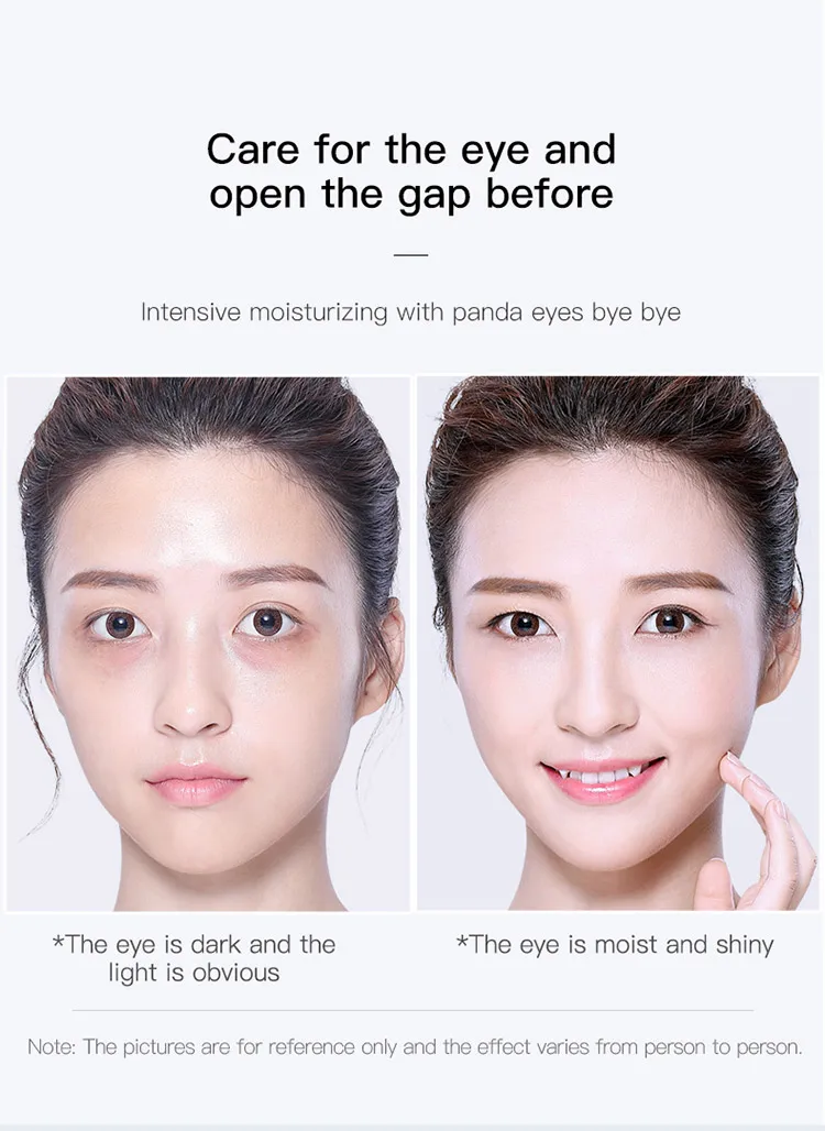 eye bag reducer