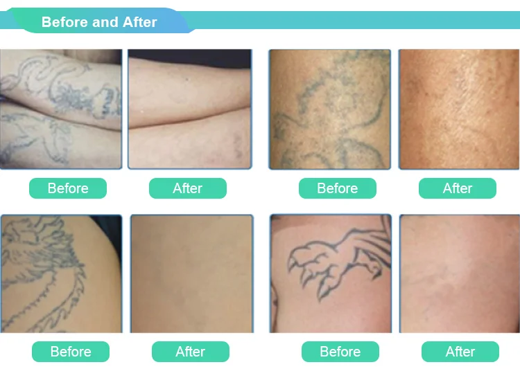 before and after.png