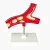Artery model