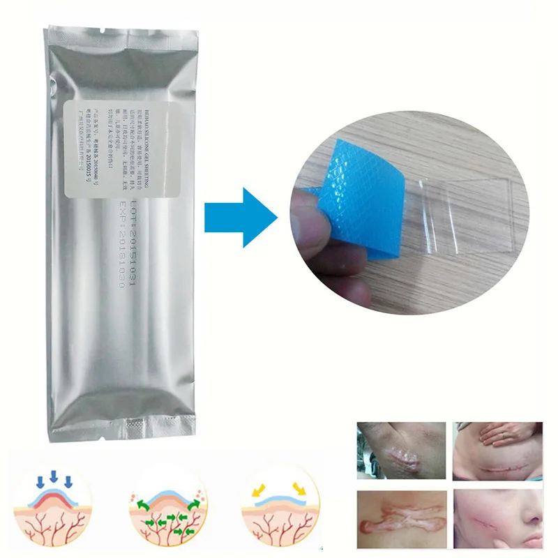 silicon scar sheet