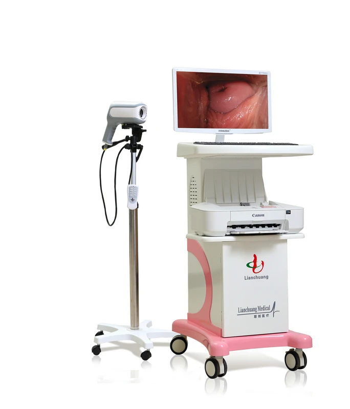 Digital Video Colposcope Equipment For Vaginal Examination - Buy ...