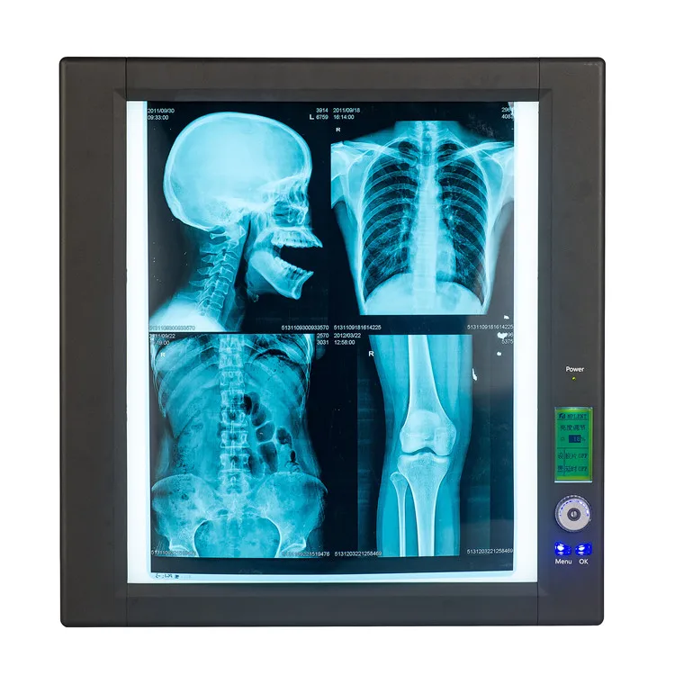 Hot sales medical LED negatoscope single x-ray film light viewing box