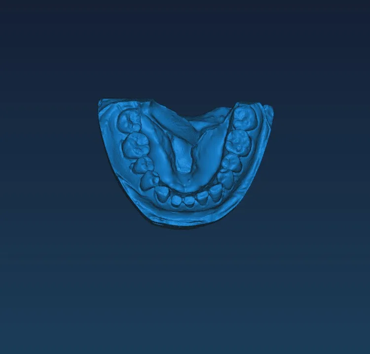 High Precision 3D Scanner Desktop 3D Scanner for Dentist Dental 3D Scanner Wholesale Tooth Mode