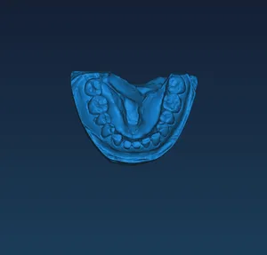 High Precision 3D Scanner Dental Use