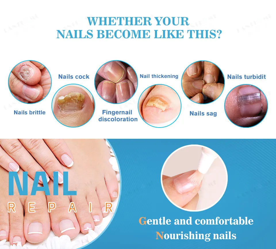 LANTHOME Natural Nail Care Oil Anti Fungus Nail Treatment Nourishing Repair Nail Serum Pen