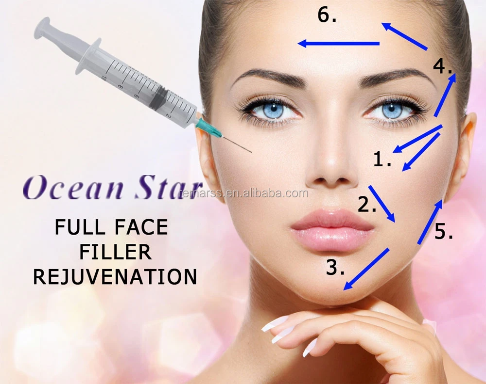 

2019 Oceanstar Hyaluronic Acid Gel Derm 2ml for lip enhancement, N/a