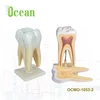 Detachable Human Teeth Models Anatomical molar teeth model medical model