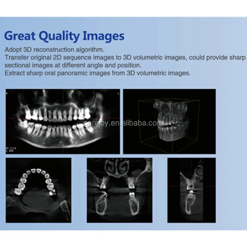 CBCT (10).jpg