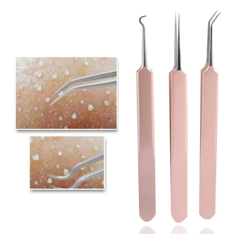

1/3pcs Blackhead Acne Stimulus Extractor Remover Tools Blackhead Tweezer, Rose gold