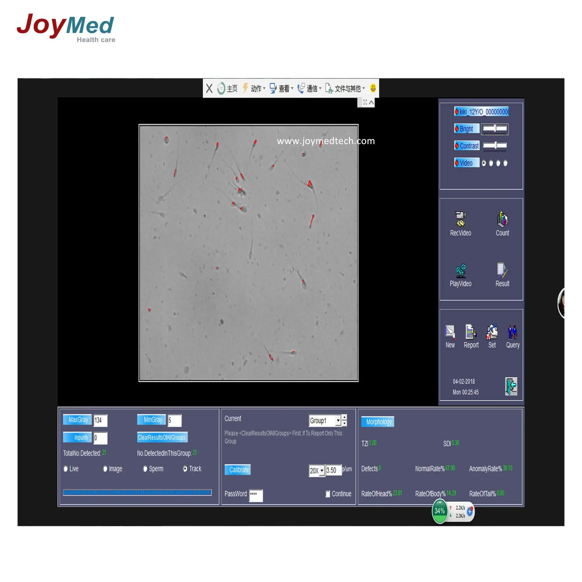 Portable Computer Assisted Hospital Sperm Machine Sperm Analyzer Buy