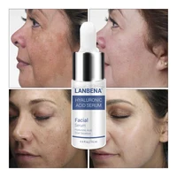 

LANBENA hyaluronic acid serum skin lightening serum free shipping