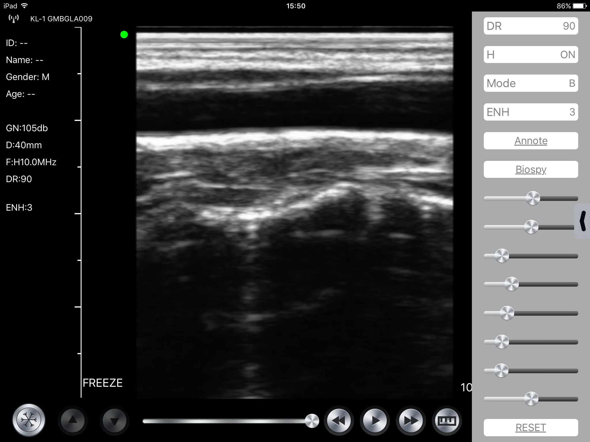 
Gen 3 Types B&w Wifi Wireless Ultrasound Probe Android Ultrasound 