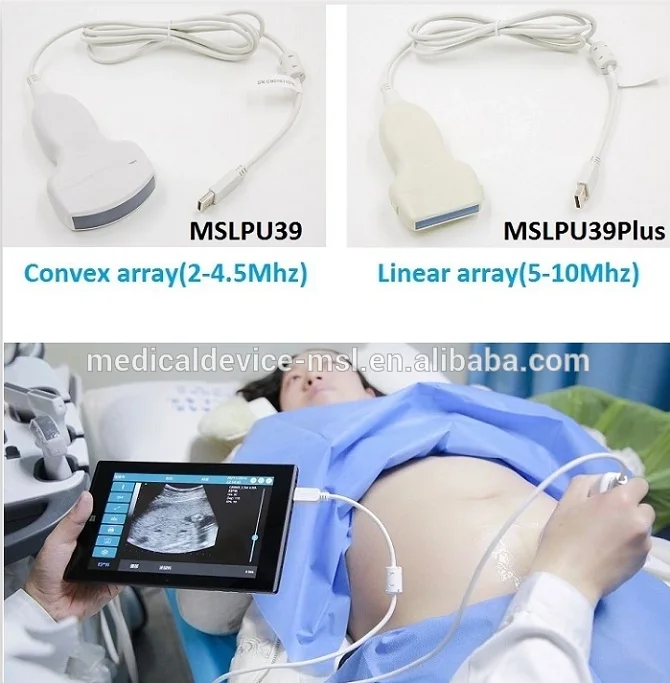 High Frequency 10mhz Linear Array Wifi Ultrasound,Multifrequency 5
