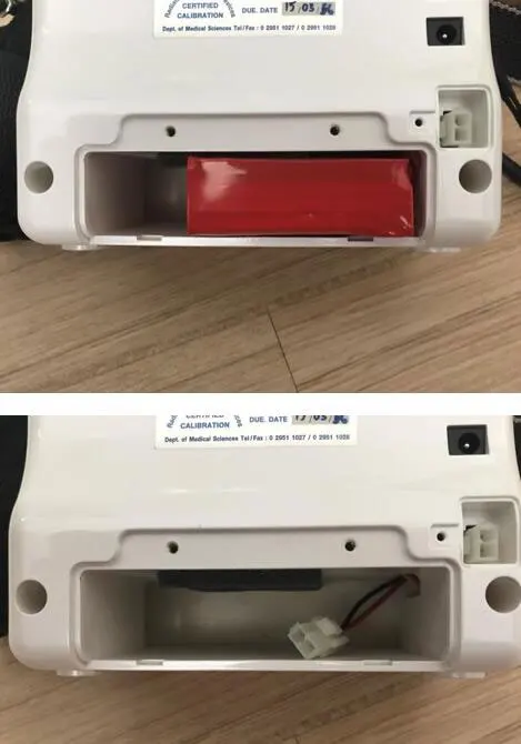 X-ray.jpg