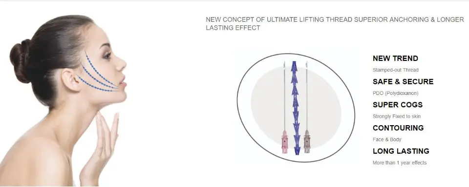 molding cog thread.jpg