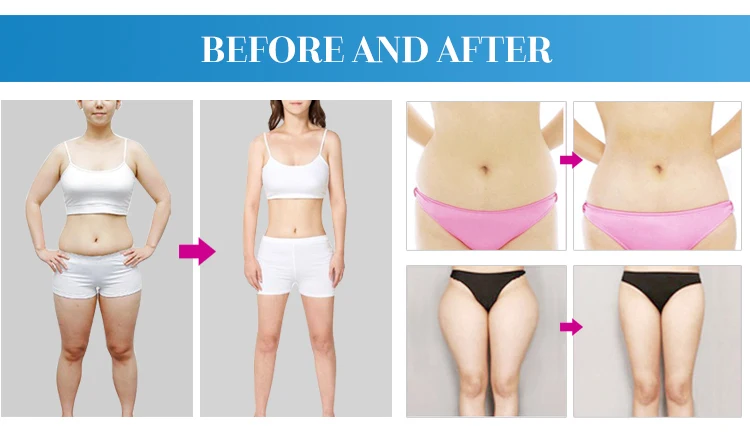 Portable Lipolaser Weight Loss 14 Laser Plates Lipo Laser Slimming Machine for Home & Salon