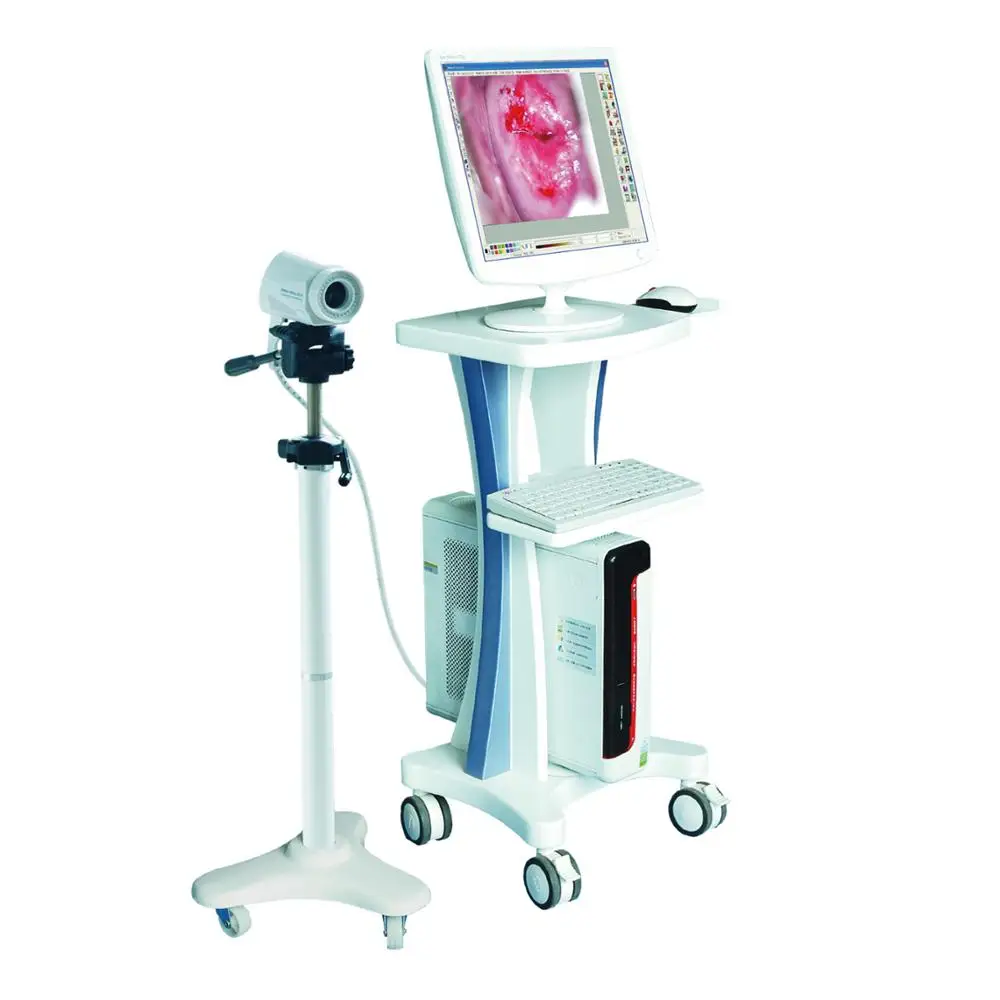 Portable Electronic Digital Imaging Colposcope for Vagina Treatment