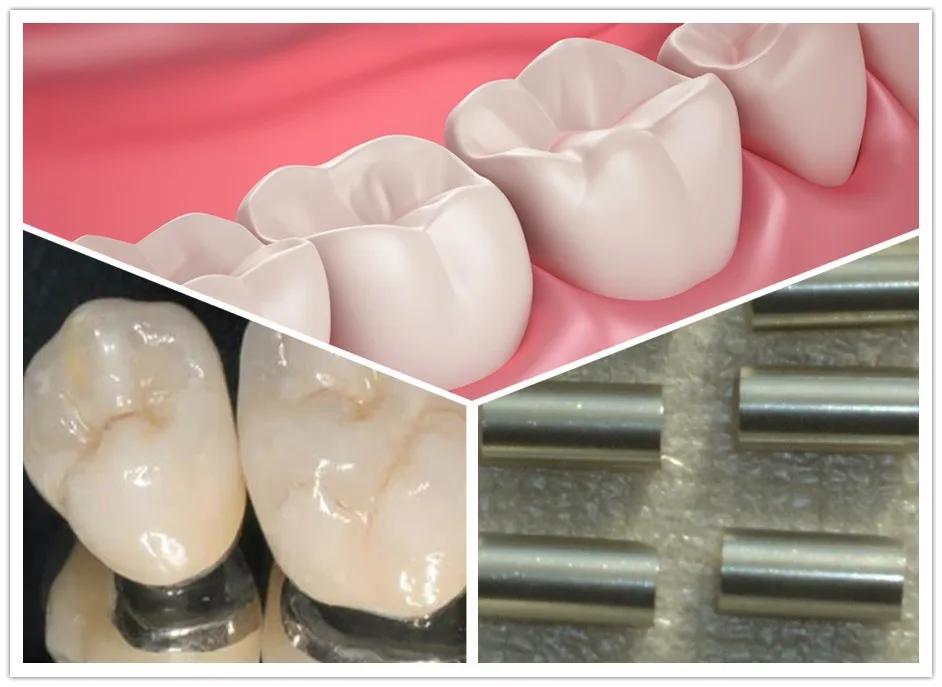 Κινεζικό νέο υλικό οδοντικό κράμα χρωμίου κοβαλτίου stellite
