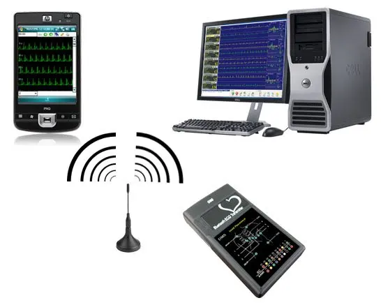 
Real time Cardiovision Telemetry ECG Monitor multi beds ECG Cardiac Rehab 