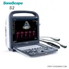 /product-detail/much-cheaper-than-mindray-m7-sonoscape-s2-3d-portable-color-doppler-ultrasound-60636479806.html