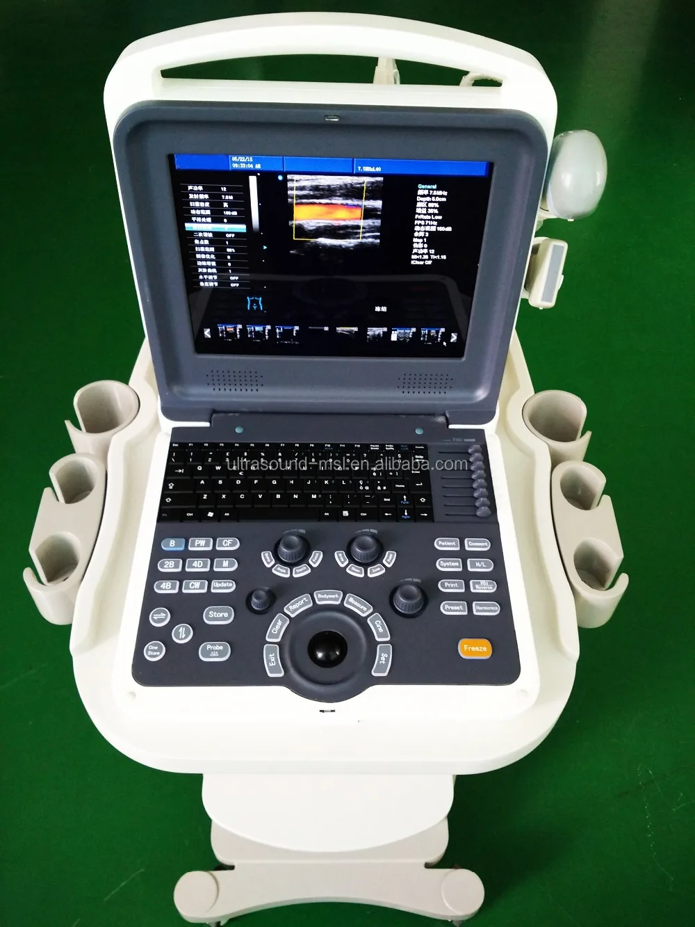 Cardiac Cw Medical Portable Echocardiography Color Doppler 4d