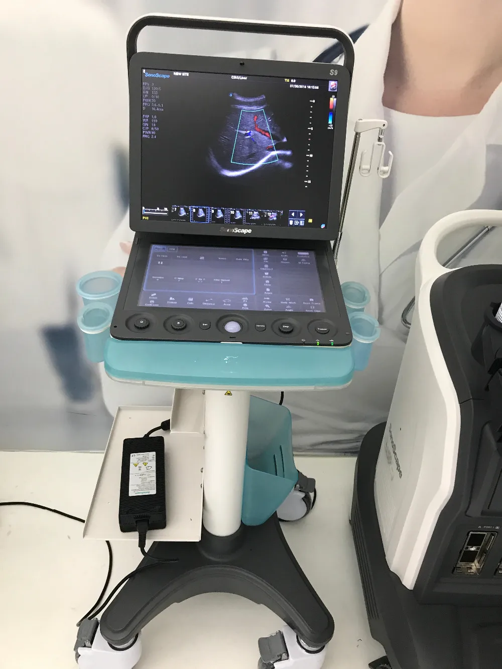 可与mindray超声机相媲美s9便携式彩色多普勒