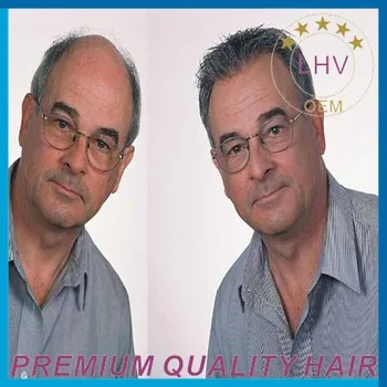 2015 New Products Men Hair Pieces Toupees Hair Replacement Men S
