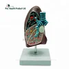 Pathology Respiratory System Pulmonary Diseased Lung Model