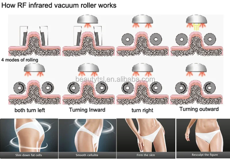 Lipo laser rf vacuum roller massage machine/body slimming vacuum roller machine/V10 velashape cavitation rf vacuum machine