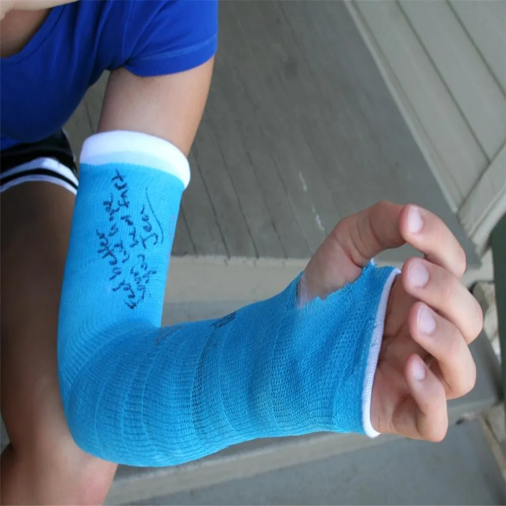 Different Colors Ortho Fiberglass Cast Tape Synthetic Bandage Buy Fiberglass Cast Colors