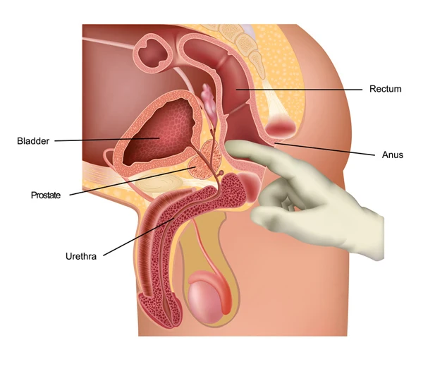 gruppen sex prostata stimulatoren gruppen sex prostata stimulatoren