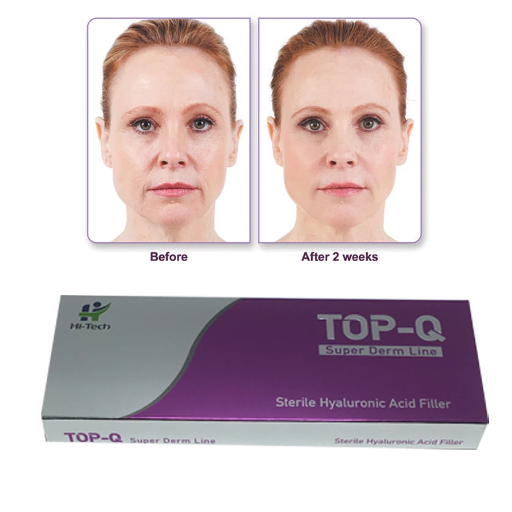 

2CC Injectable Hyaluronic Acid Dermal Filler Facial Lifting HA Injection For Lip /Anti-wrinkle