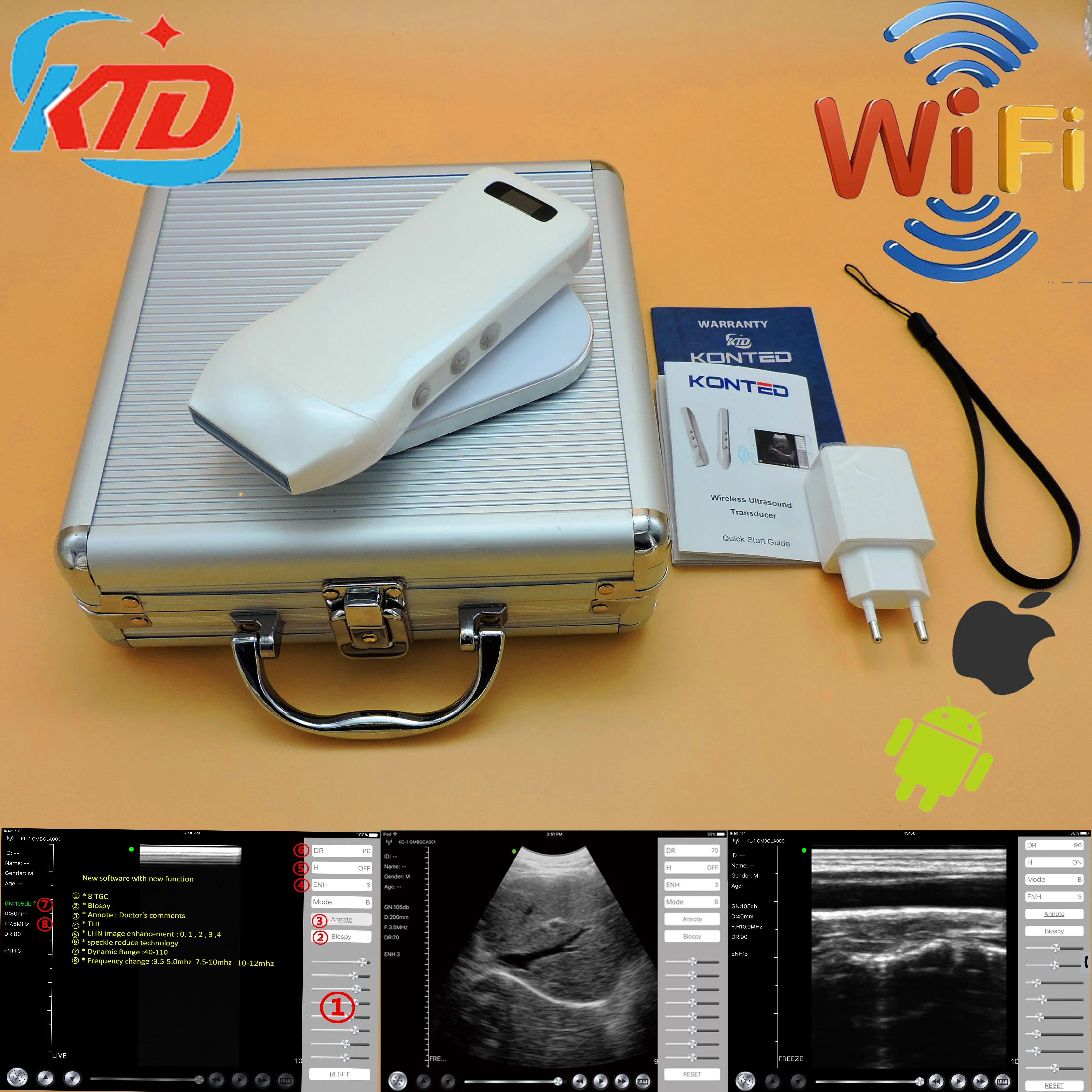 
Gen 3 Types B&w Wifi Wireless Ultrasound Probe Android Ultrasound 