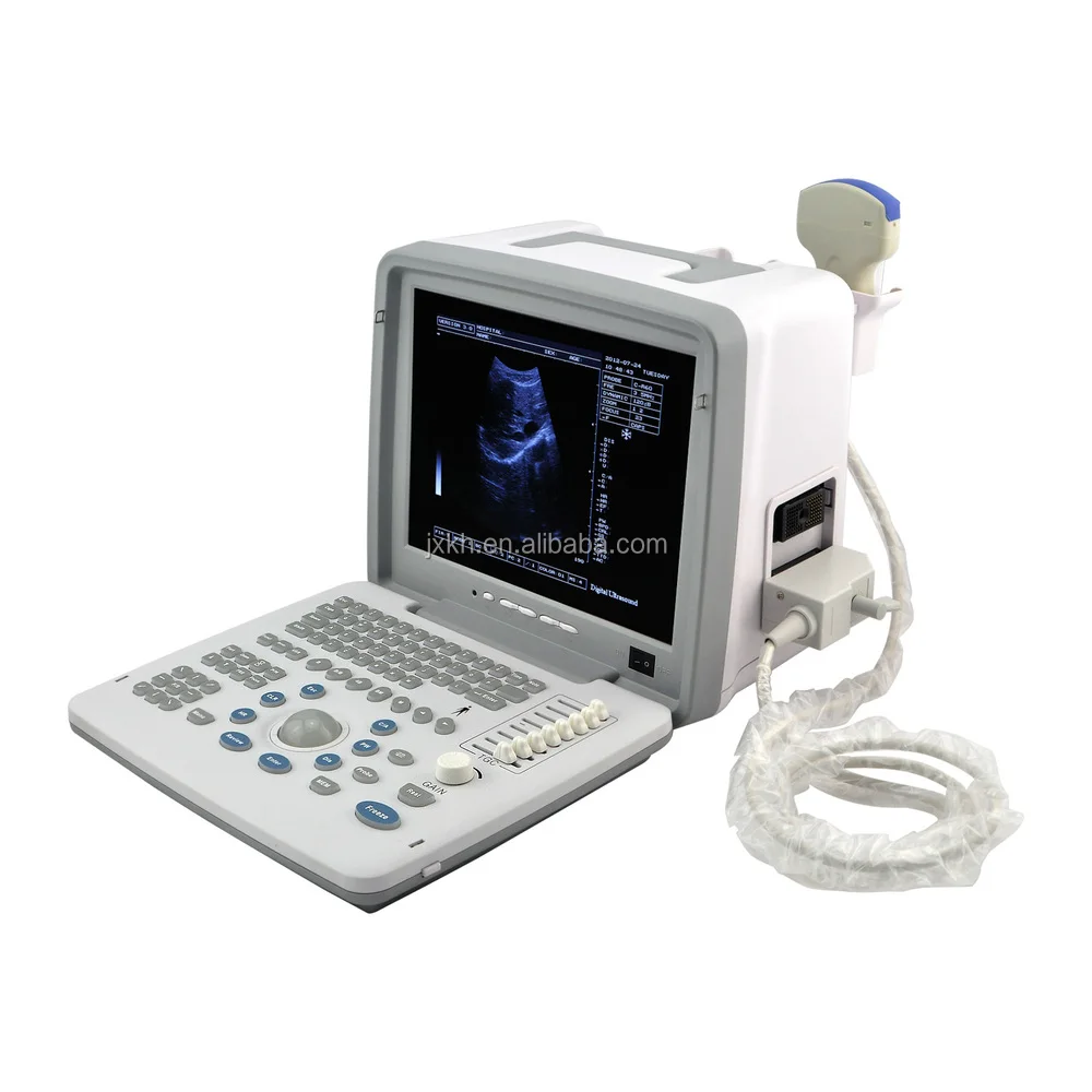 Large Screen Good Image Full Digital Portable Ultrasound Scanner