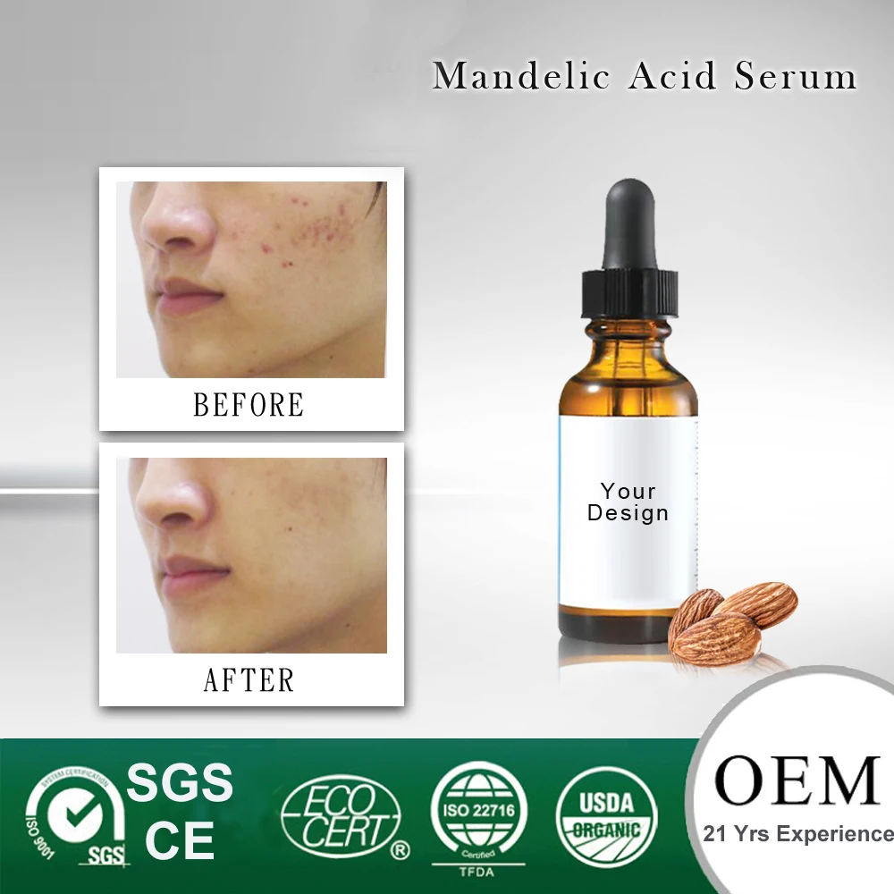 best mandelic acid serum