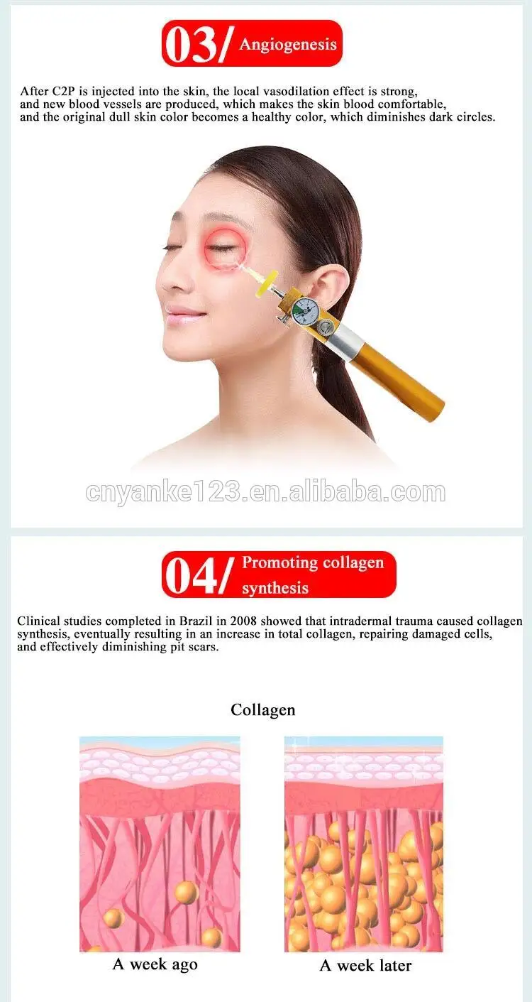Stretch mark removal CDT carboxytherapy C2P injecting wrinkle removal skin breath device beauty machine