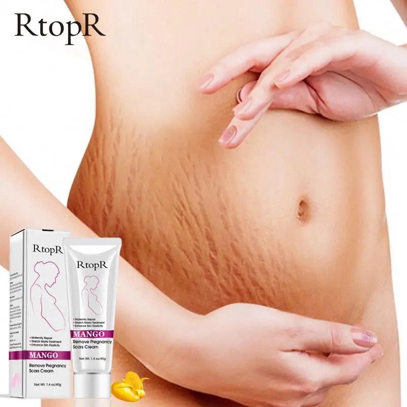 

OEM Natural Herbal Extract Body Skin Acne Scar Stretch Marks Removal Face Cream