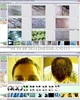 CompareView Hair Analysis Software