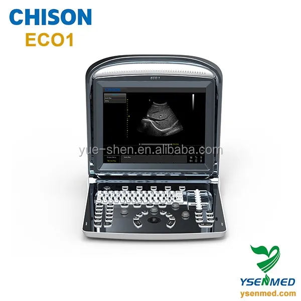 ysenmed sells CHISON ECO1 portable BW ultrasound machine