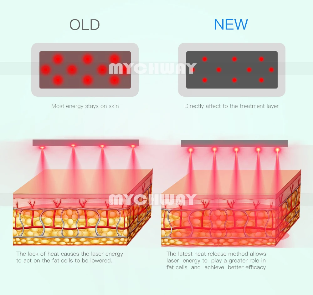 High Quality Best Price Obvious Effect Lipo Laser /lipo Slim! Lipolaser