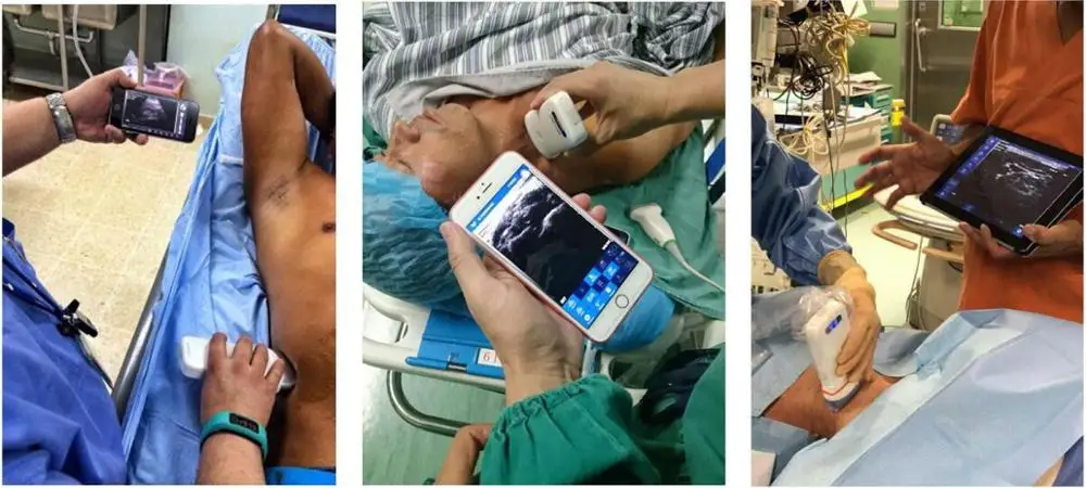 Doppler ultrasound Transducer USG small ultrasonic transducer wireless ultrasound Probe Machine