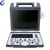Portable Echocardiography 4D Color Doppler Ultrasound Scanner, Portable Echo Ultrasound Machine For Pregnancy