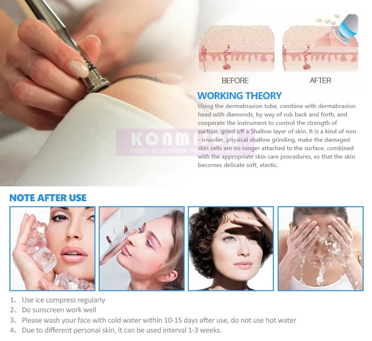 Three in one diamond dermabrasion instrument (LB179) (4)