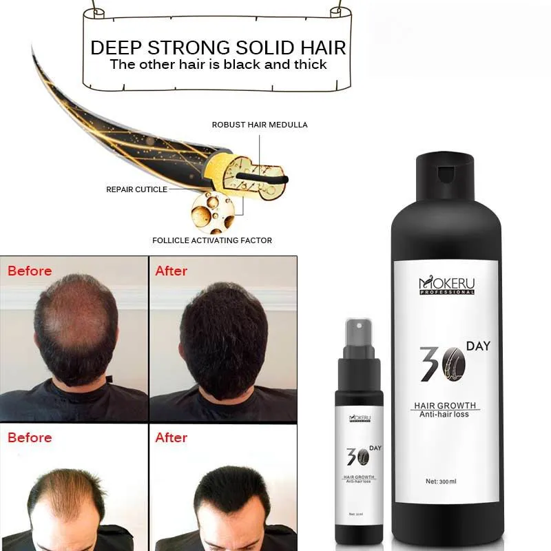 Fda approved hair growth treatment