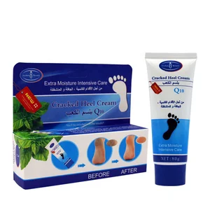 Natural Foot Peeling Feet Dry Moisturizing Dead Skin Removal Repair Cracked Heel Foot Massage Cream