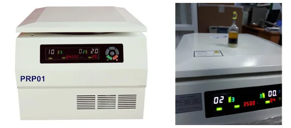 prp centrifuge machine for hair loss