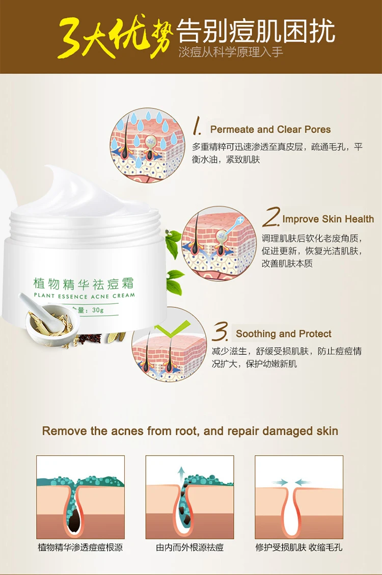ACNE CREAM 9.jpg