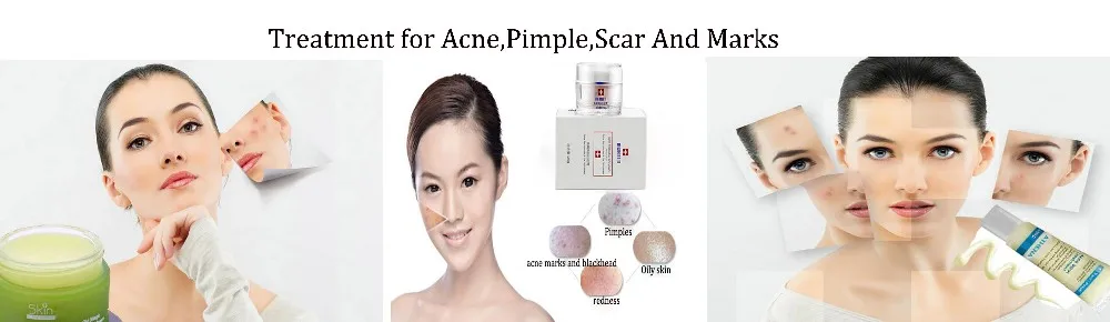 bio essence acne control