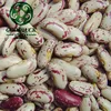 CIQ Different Size of Light Speckled Kidney Beans in Bulk
